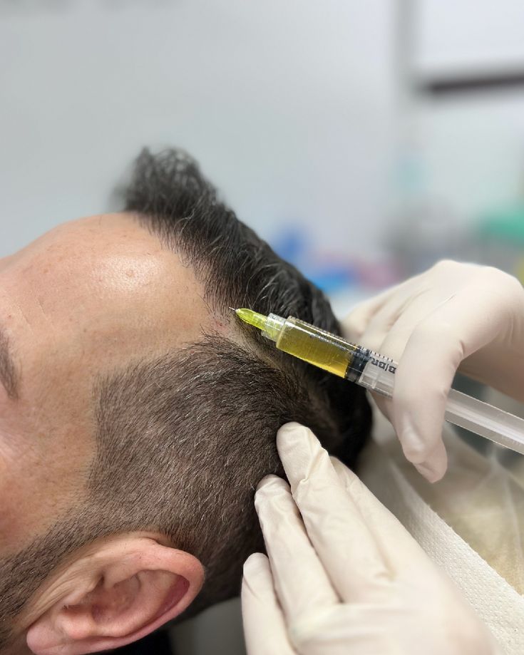 ESTIMULACION CAPILAR